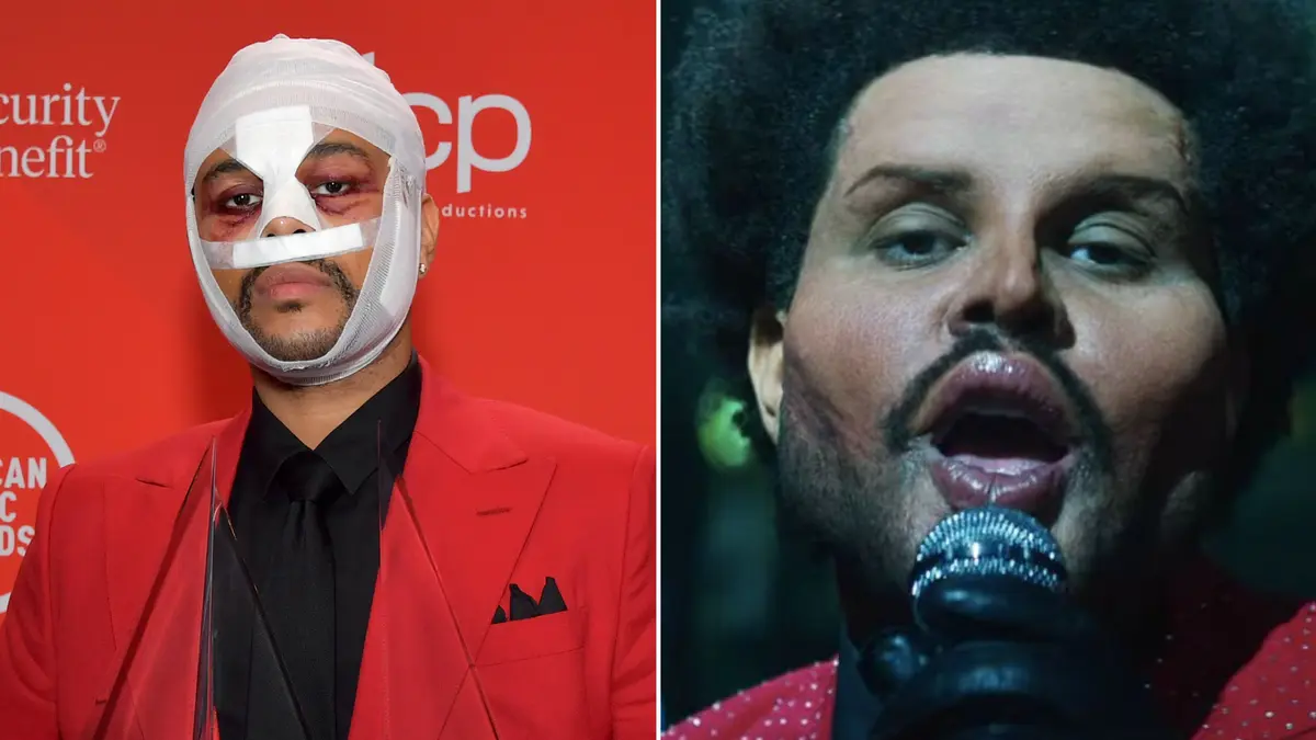 The Weeknd debuts post-'plastic surgery' look - but is everything as it seems?